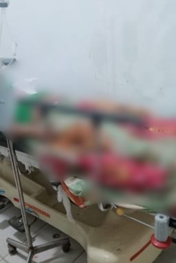 Pemuda Desa Kou Koma Usai Diduga Dikeroyok OTK di Desa Mangoli, Keluarga: Kapolres Segera Tangkap Pelaku Secepatnya 1×24 Jam